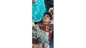 চাঁপাইনবাবগঞ্জে মামীর সাথে পরকীয়ার জেরে যুবকের কব্জি কেটে নিয়েছে মেয়ের পরিবার