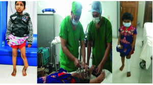 চাঁপাইনবাবগঞ্জে সুখীমনের ৭ বছরের  বাঁকা পা  সোজা করলেন ডা. ইসমাইল 