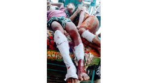 নাচোলে জমিজমার বিরোধে নিজ আত্মীয়ের দ্বন্দে পিতা-পুত্র  আহত